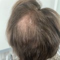 The Truth About Age Restrictions for Wearing Hair Extensions