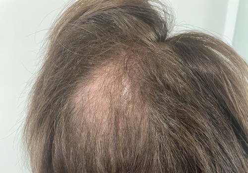 The Truth About Age Restrictions for Wearing Hair Extensions